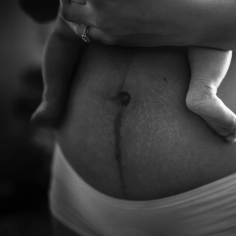 Why the 6 week postnatal check is not enough
